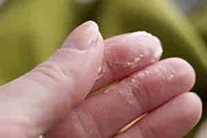 Чем стереть супер-клей с различных поверхностей: пошаговые инструкции и советы